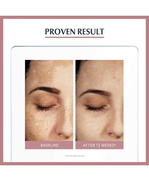 Eucerin - Antipigment Dual Serum Anti Spots 30 mL