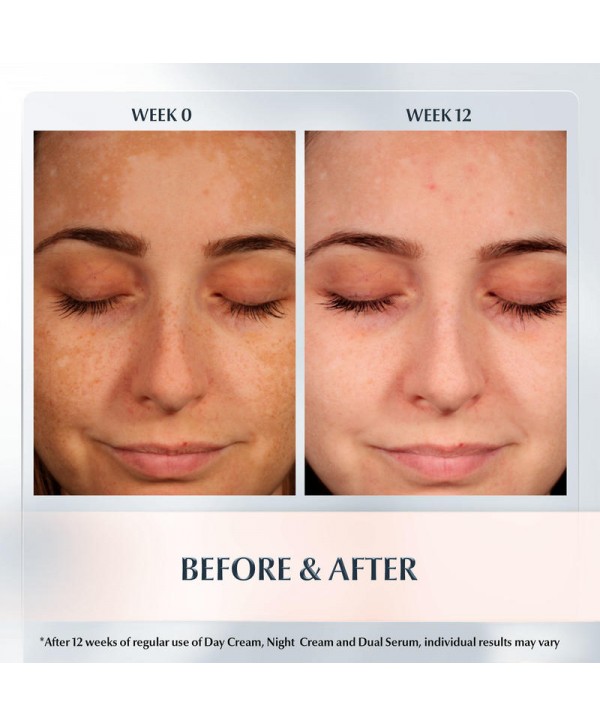 Anti Pigment Night Cream - Eucerin